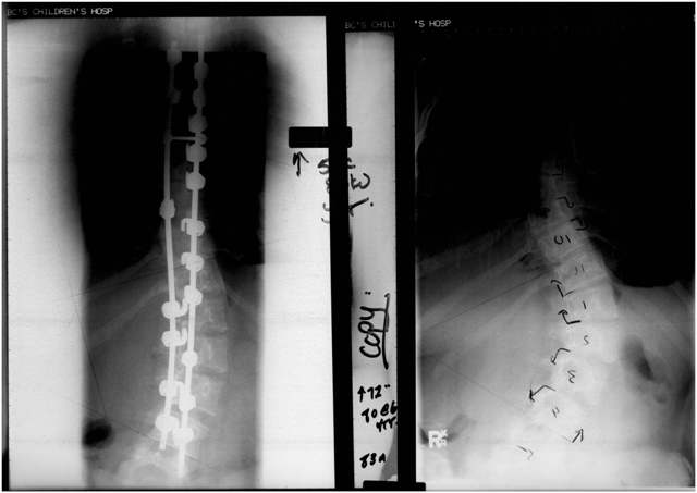 Liz's spine small